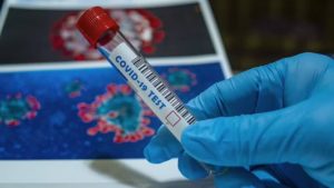 Gallery photo 2 for Covid-19 Antigen (Rapid) Test & PCR Test in Your Accommodation or at the Doctor's office in Naxos